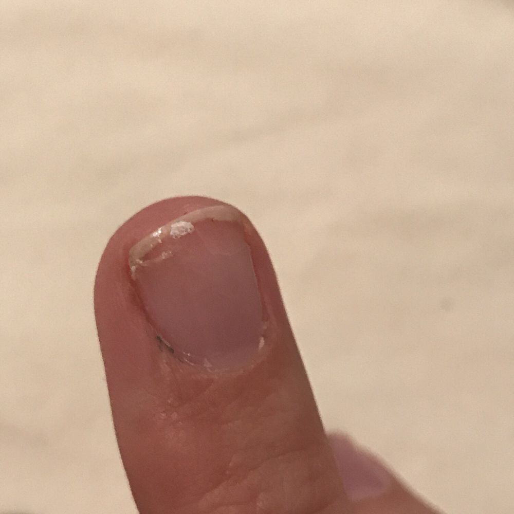 Nail City - Gel French Manicure, nail completely chipped off 3 days post manicure. - Nail Salons Near Me - Aberdeen, North Carolina Nail City - Gel French Manicure, nail completely chipped off 3 days post manicure. - Nail Salons Near Me - Aberdeen, North Carolina