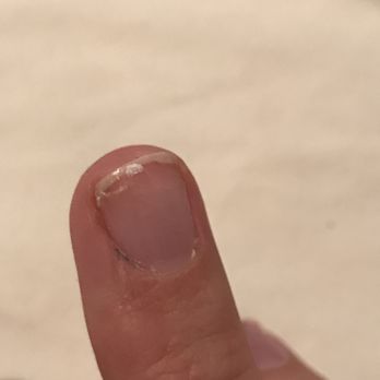 Nail City - Gel French Manicure, nail completely chipped off 3 days post manicure. - Nail Salons Near Me - Aberdeen, North Carolina