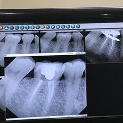 Kevin B Melker, DDS, MS