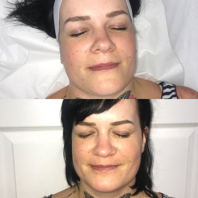 New You Laser by null