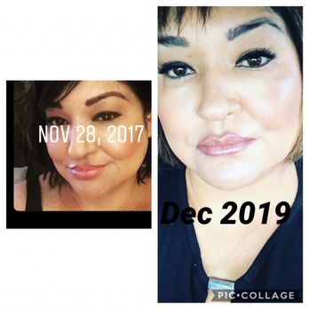 Heavenly Faces - Get real results with the newest treatments aqua gold Botox facial, - Skin Care Near Me - Flower Mound, Texas Heavenly Faces - Get real results with the newest treatments aqua gold Botox facial, - Skin Care Near Me - Flower Mound, Texas