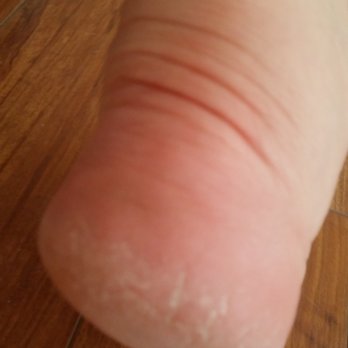 iNails Salon - I just had a pedicure here 30 mins ago. I told them my heels are rough, they told me next time we fix. Whaaat? This place is horrible. - Nail Salons Near Me - Geneva, New York iNails Salon - I just had a pedicure here 30 mins ago. I told them my heels are rough, they told me next time we fix. Whaaat? This place is horrible. - Nail Salons Near Me - Geneva, New York