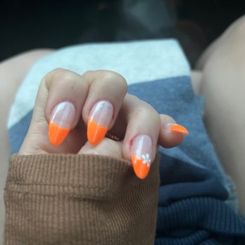 Chloe Nails - 2 cuts on finger - Nail Salons Near Me - Lomita, California