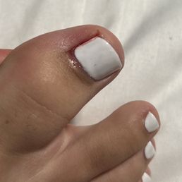 Applied nail polish on a bleeding nail.