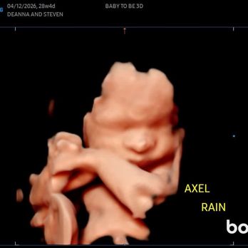 Baby To Be 3D - Ultrasound Imaging Centers Near Me - Luzerne, Pennsylvania Baby To Be 3D - Ultrasound Imaging Centers Near Me - Luzerne, Pennsylvania