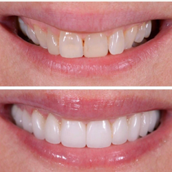 AC Dentistry