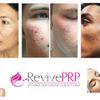 RevivePRP gift card