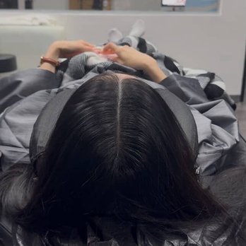 Chuldu Scalp Micropigmentation - Hair Loss Centers Near Me - Los Angeles, California
