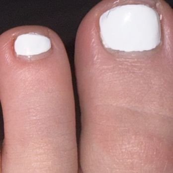 Nail Box - Top left corner of big toe, jagged bottom and too far from cuticle - Nail Salons Near Me - Edmond, Oklahoma Nail Box - Top left corner of big toe, jagged bottom and too far from cuticle - Nail Salons Near Me - Edmond, Oklahoma