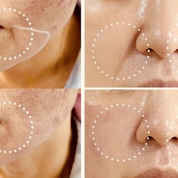 Pure Renewal Therapy Studio - Skin care - Massage Therapy Near Me Pure Renewal Therapy Studio - Skin care - Massage Therapy Near Me