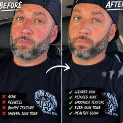 KM Skincare By Kacy McInturff