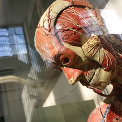 Dittrick Museum of Medical History - Auzoux anatomy model, ca. 1920.