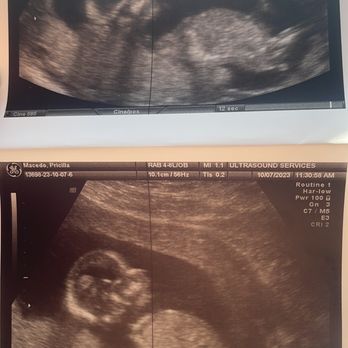 Ultrasound Services - Full body pics ^.^ - Ultrasound Imaging Centers Near Me - Santa Ana, California Ultrasound Services - Full body pics ^.^ - Ultrasound Imaging Centers Near Me - Santa Ana, California
