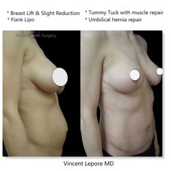 Vincent Lepore Md