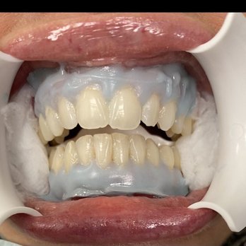 Mid Island Dental Arts - During - Oral Surgeons Near Me - Bethpage, New York Mid Island Dental Arts - During - Oral Surgeons Near Me - Bethpage, New York