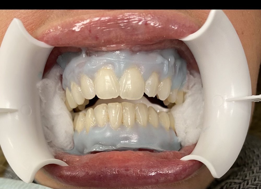 MID ISLAND DENTAL ARTS Updated October 2024 4277 Hempstead Tpke