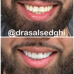 Asal Sedghi, DDS - Before/After