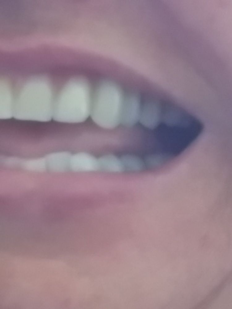 NOVA DENTURE AND IMPLANT CENTRE Updated October 2024 1439 Ogilvie