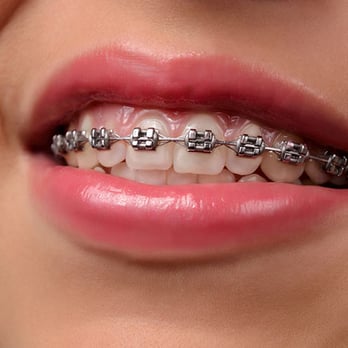 OC Dental Specialists - Orthodontists Near Me - Tustin, California OC Dental Specialists - Orthodontists Near Me - Tustin, California