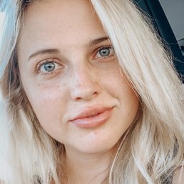 This is about an hour after getting my lips done.  They look great!!! Dr Tara Zeiber is amazing. They look natural for my face.