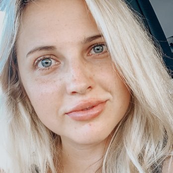 De Luz Medical Aesthetics - This is about an hour after getting my lips done.  They look great!!! Dr Tara Zeiber is amazing. They look natural for my face. - Medical Spas Near Me - Temecula, California