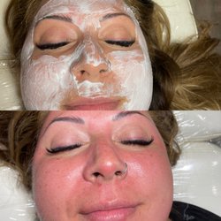 Beauty Brows By Kellie - Microneedling