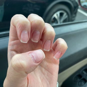 Dream Nails - You can see how they even made a while in my nail after taking the SNS perder off, what a terrible experience - Nail Salons Near Me - Gastonia, North Carolina