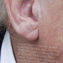 Café 242 - Closeup of President Trump's non-injury !!!   "It's a miracle!"