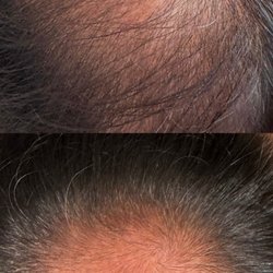 Luxury Medical Spa - 6 month comparison