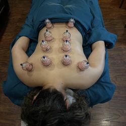 Harmonizing Muscle Knots - We offer cupping of an enhancement I recommend pairing this with a massage. Have any questions about coupling call me today.