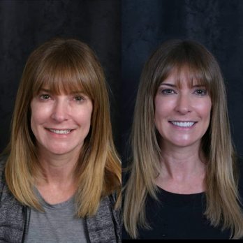 Advanced Dentistry at Windhaven - Oral Surgeons Near Me - Plano, Texas