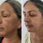 Honeys Skincare
