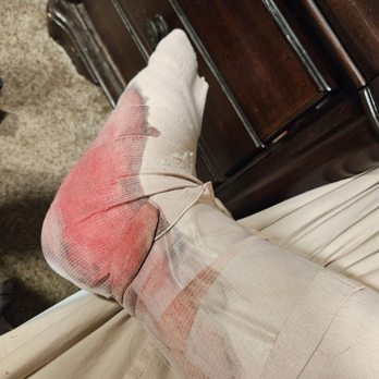 Med1Care - This isn't worth sending a after hours nurse for. I was told to clean it up and re-dress it myself. . - Home Health Care Near Me - Findlay, Ohio Med1Care - This isn't worth sending a after hours nurse for. I was told to clean it up and re-dress it myself. . - Home Health Care Near Me - Findlay, Ohio