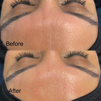 Derma Radiant Spa - Skin Care Near Me - Pearland, Texas Derma Radiant Spa - Skin Care Near Me - Pearland, Texas