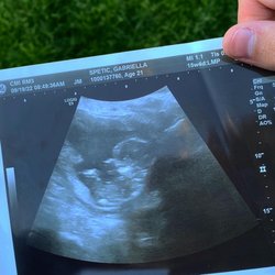 Central Oregon Radiology Associates - Healthy baby
