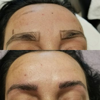 Bare Body Bar - Hair Removal Near Me - Toronto, Ontario