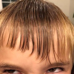 A terrible haircut.