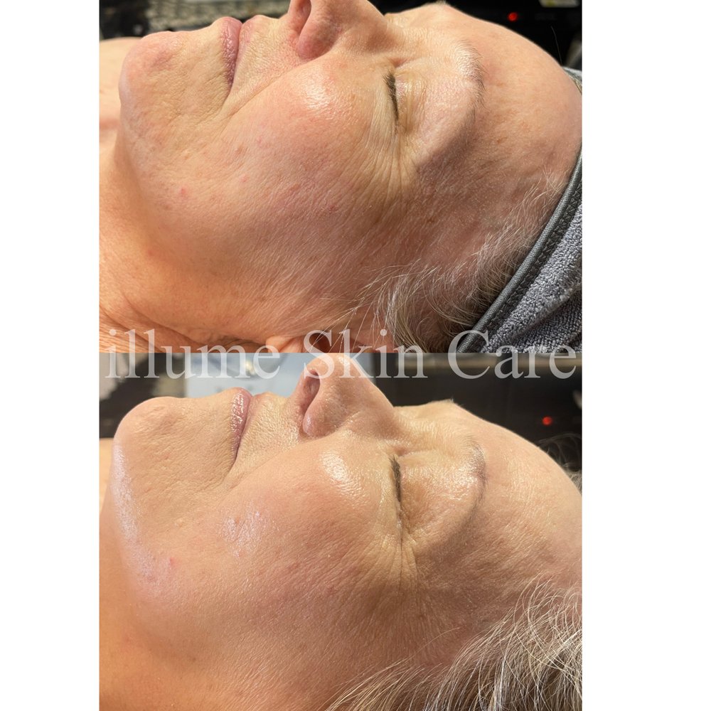 Katta kokraklar sutyenda