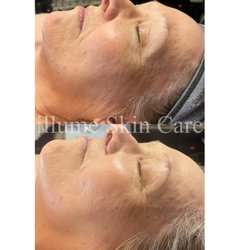Illume Skin Care - Hydrated and glowing!!