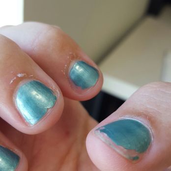 AT Deluxe Nails & Spa - Red cuticles and fraying cuticles. - Nail Salons Near Me - Albany, New York AT Deluxe Nails & Spa - Red cuticles and fraying cuticles. - Nail Salons Near Me - Albany, New York