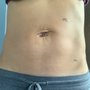 Photo of Torrance Hernia Center