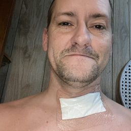 Tomorrow morning is my 2 week follow up after my surgery with Dr Arakal Tomorrow morning is my 2 week follow up after my surgery with Dr Arakal