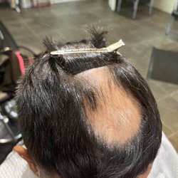 All Dolled Up Hair Studio - Alopecia