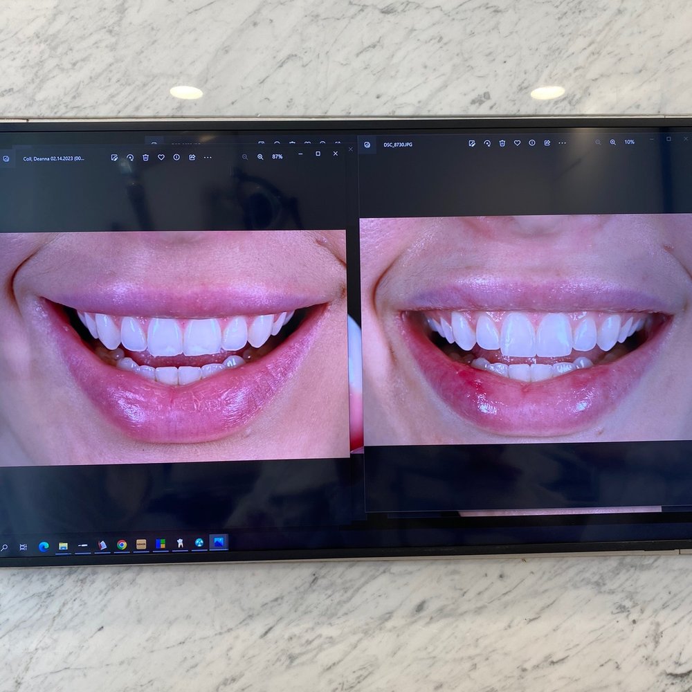 Apa Aesthetic NY - Before and after - Cosmetic Dentists Near Me - New York, New York