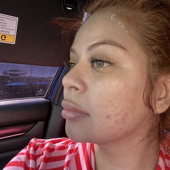 PHD Esthetics - Skin Care Near Me - Tustin, California PHD Esthetics - Skin Care Near Me - Tustin, California