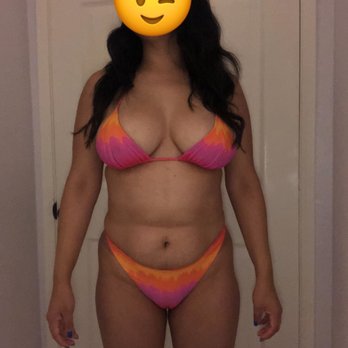 Amy Bandy - Before - Cosmetic Surgeons Near Me - Newport Beach, California Amy Bandy - Before - Cosmetic Surgeons Near Me - Newport Beach, California