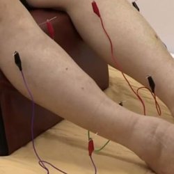 UCee Acupuncture Clinic