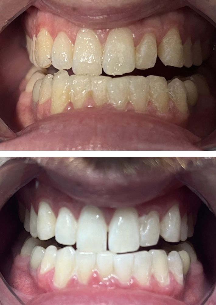 NATURALLY WHITE FORT WORTH Updated August 2024 16 Photos 1009