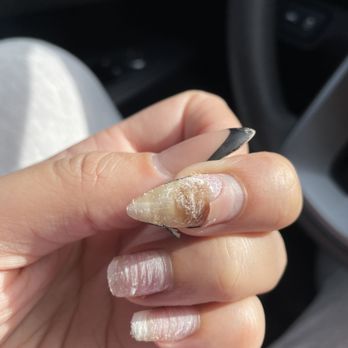 Legacy Nails & Spa - Discoloration on real nail - Nail Salons Near Me - Oklahoma City, Oklahoma Legacy Nails & Spa - Discoloration on real nail - Nail Salons Near Me - Oklahoma City, Oklahoma