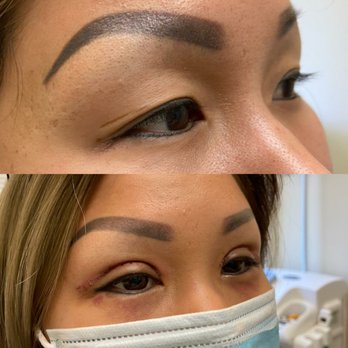 La Bella Cosmetic Surgery - Cosmetic Surgeons Near Me - San Jose, California La Bella Cosmetic Surgery - Cosmetic Surgeons Near Me - San Jose, California